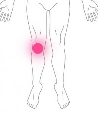 変形性膝関節症１
